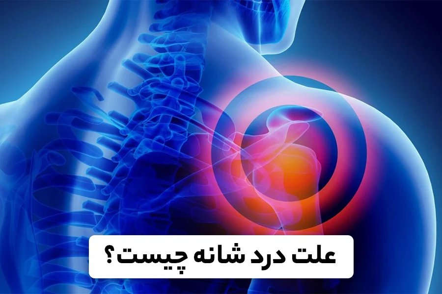 علت درد کتف و شانه چپ و روش های درمان