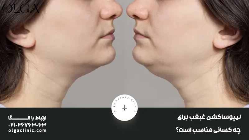 جراحی | زیبایی ساکشن غبغب چیست؟